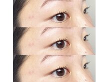 ヒア(Here.)/#まつ毛パーマ#ラッシュリフト