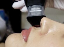 バイ リス(by LYS.)/【リフトマニア】施術工程