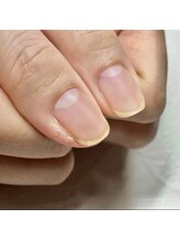 イズム(Izm)/自爪風