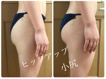 パワーレメディ1回の効果。重力に負けないまーるい小尻に