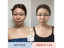 雪月風花 自由が丘の雰囲気（食いしばりは首肩はもちろん、身体全体の緊張と関係しています。）