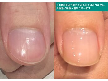 地爪ケアクリニックサロン 代々木店/爪切りは身だしなみです!