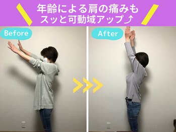 京都中丸整体カイロプラクティック/肩の痛み