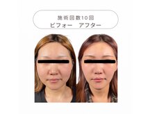 ワンモア 新町店(1+MORE)の雰囲気（むくみ顔専門５回でモデル級小顔に！唯一無二やせ見え小顔矯正）