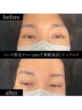 ユー 千葉駅前店(you)/ビフォ－アフター写真