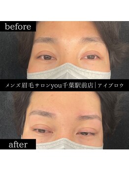 ユー 千葉駅前店(you)/ビフォ－アフター写真