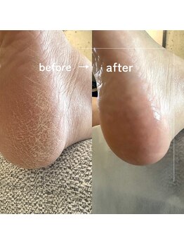 ゼロハチイチ(081)の写真/1回で実感する、フワフワ足裏体験◇BEBE CARE Spa