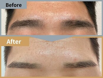 眉毛ハウス 吉祥寺店(眉毛HOUSE)/お客様の施術例(吉祥寺/東京)