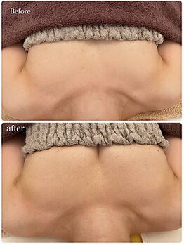 美人バスト 千葉店/バストケア