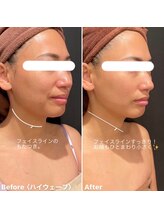 ミエル 神戸店(Miel)/HIRFWAVEハイアールエフウェーブ