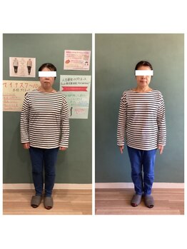 パンダ(Panda)/DNA検査体質改善ダイエット