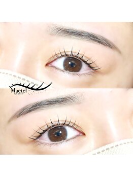 トリコ 調布(TRICO)/メーテルロッド