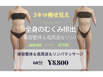 リカバリー(&recovery)の写真