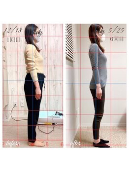 あんず美容整体サロン/◆姿勢症例◆