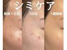 徹底シミケア　10個コース！☆初回の方☆【デコルテリンパマッサージ付き】