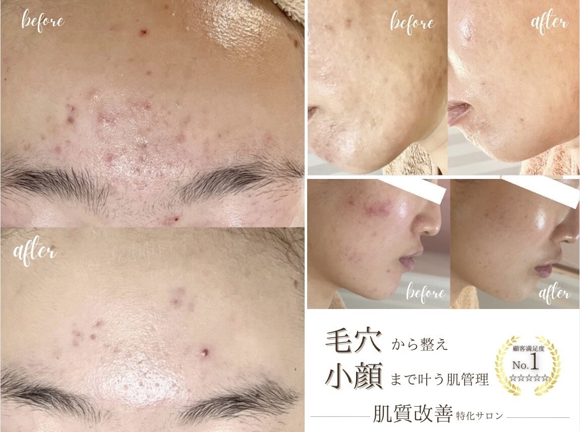 ソワンドビジュー(soin de bijew)｜ホットペッパービューティー