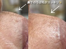 アイラッシュユーリ(Eyelash Juli)の雰囲気(~フェイシャルワックス~WAX顔脱毛 お肌つるつるトーンアップ!)
