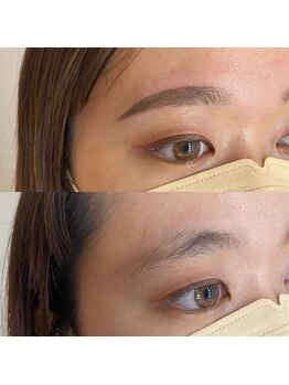 エールバイボヌール(Ere by Bonheur)/自己処理修正　3～5回で完成