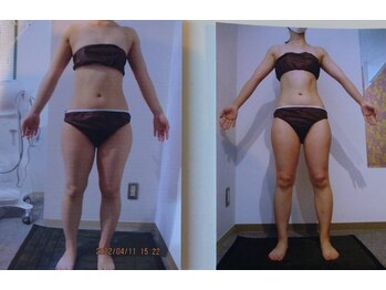 パーフェクトボディプレミアム 札幌駅前店(PERFECT BODY PREMIUM)/お客様　ビフォーアフター（17）