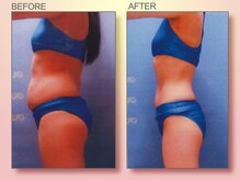 ジュリア オージェ 天王寺店/ビフォーアフター（脂肪燃焼）