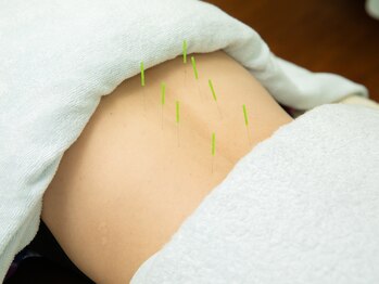 町田鍼灸院/どこに行っても改善しない不調に