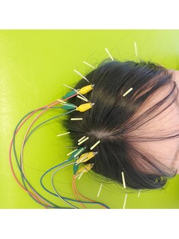 はり灸心音/頭鍼比較-スペシャル☆☆☆