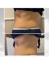 ラン(Ran)/変化写真♪