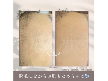 モア トゥインクル 緑井店(MORE twinkle)の写真