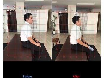 ストレチックス 近江八幡店/姿勢改善ビフォーアフター1回