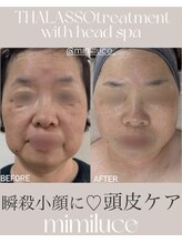 ミミルーチェ(mimiluce)/タラソと美脳小顔ヘッドスパset