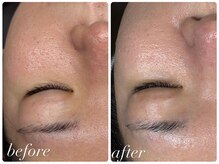 ビノスビューティー(vinos.beauty)/ReLABEAUTEタラソトリートメント