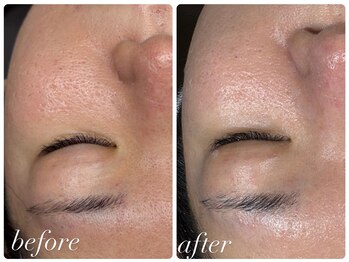 ビノスビューティー(vinos.beauty)/ReLABEAUTEタラソトリートメント