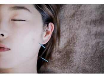 ハリファ鍼灸院 伏見栄院(HariFa鍼灸院)/確かな技術の美容鍼