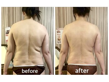 リムアール(Limh R)/