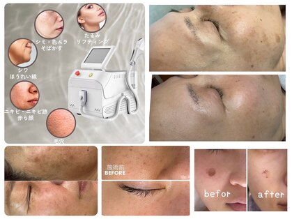 エスボーテ(sbeaute)の写真