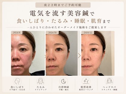 ナオ鍼灸院(Nao鍼灸院)の写真