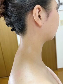 ユウ(You.)の写真/【一度は試して欲しい！うなじ美人ワックス】魅力的なツルスベ肌に★後ろ姿美人目指しませんか？