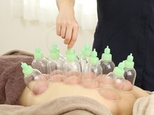 村の整骨院 鍼灸院/施術風景