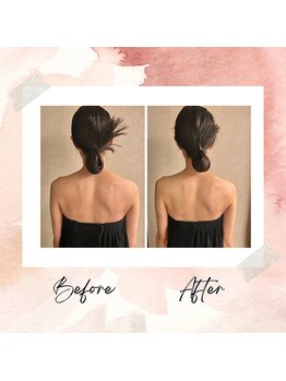 プレジール(Plaisir)/コルギ＆筋膜リリース＆EMS