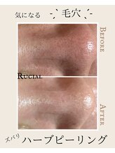 ルシアル(Rucial)/