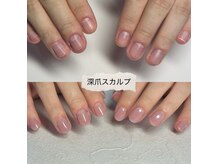 パズルリングネイル(Puzzle.ring Nail)/深爪スカルプワンカラー