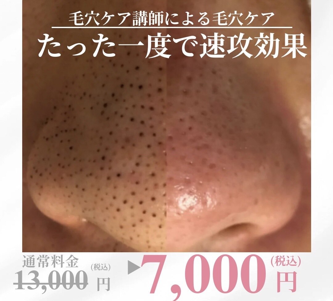 津市で毛穴ケアが人気のエステサロン｜ホットペッパービューティー