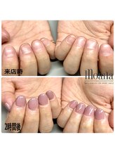 モアナ 池袋(MOANA)/人工爪長さだし