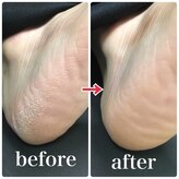 ゾゾ イリプレッセブル(ZOZO irreplaceable)