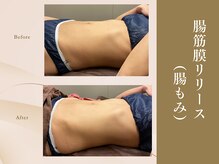 ピーエスエステ 富田林金剛店(PSエステ)/腸筋膜リリース（腸もみ）