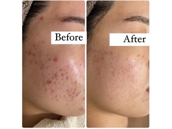 エルア 尼崎(Elua)/