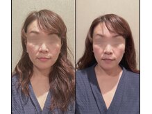 ラースパ アザブ(La SPA azabu)/La SPA麻布小顔ドライヘッドスパ