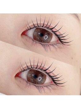 オルト(ORT)/ラッシュリフト