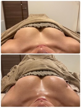 美人バスト 札幌店/バストアップ×育乳◇症例◇