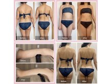 浮腫みをとり一回の施術でもこのような変化が期待できます！